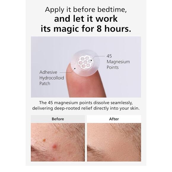EasyDerm Quick Calming Magnesium Patches – Hydrocolloid Acne Spot Treatment New - Picture 4 of 10